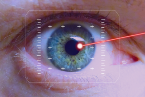 How does Lasik surgery work?